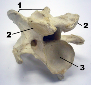 cara posterior de la vertebra cervical