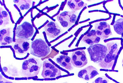 Bacillus anthracis
