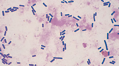 Clostridium perfringens