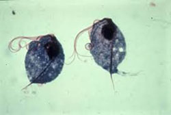 Trichomona foetus