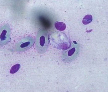 Trichomona gallinae