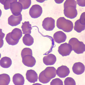 Trypanosoma brucei