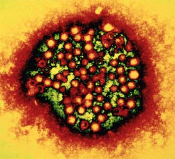 Virus hepatitis A