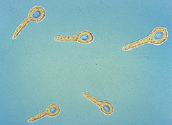 Clostridium tetani
