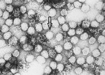 Flavivirus