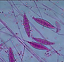 Microsporum