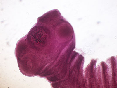 Taenia saginata
