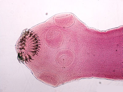 Taenia solium