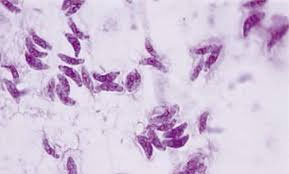 Toxoplasma gondii