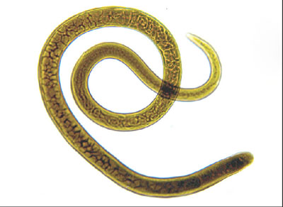 Trichinella