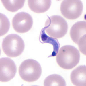Trypanosoma cruzi