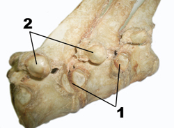 Articulación costo vertebral 