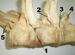 Articulaciones entre las costillas y las vertebras