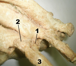Vista superior lateral de la articulación costovertebral